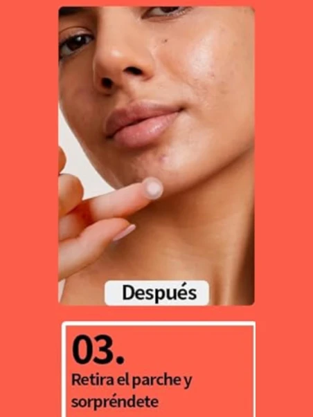 LABCARE PATCH ESPINILLAS E IMPERFECCIONES 30 UNIDADES